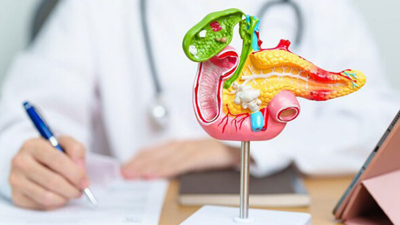 Pancreatic Cancer: Causes and Warning Signs