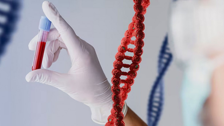 What is Prenatal Genetic Screening? - Early Genetic Defect Detection