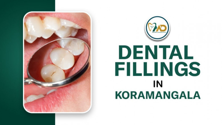 Fix Cavities Fast with Pain-Free Dental Fillings in Koramangala