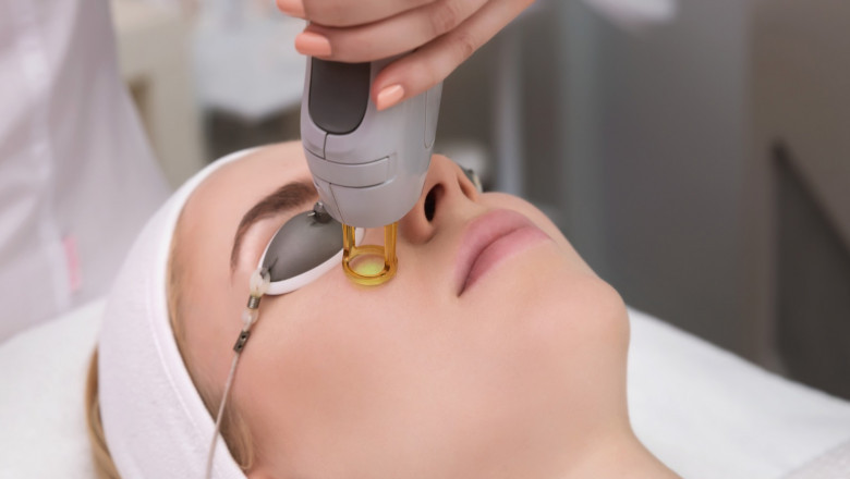 Fractional Laser: Managing Potential Side Effects