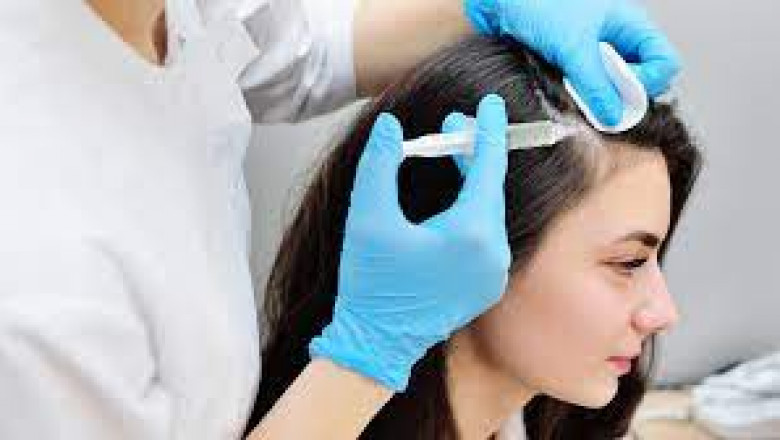 Hair Plasma Therapy: What You Need to Know Before Starting