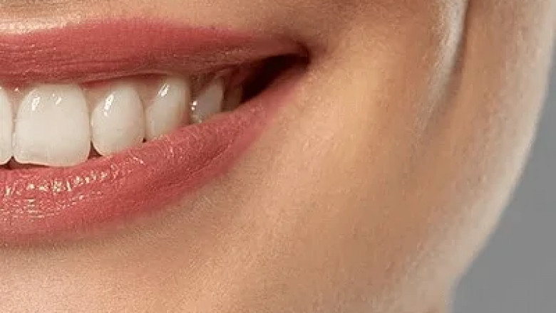 Dimple Creation in Dubai: Affordable Cosmetic Enhancement