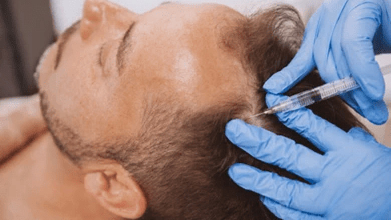 GFC Hair Treatment in Dubai: Proven Results for Hair Growth