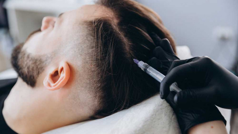 Dubai's GFC Hair Treatment: Success Stories Shared