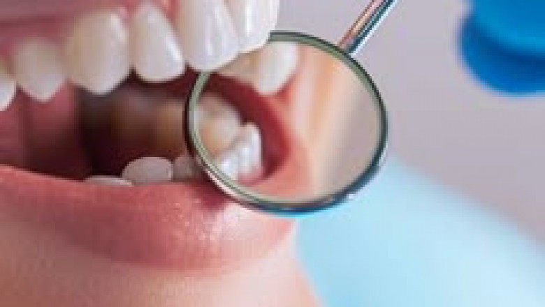 From Implants to Veneers: Best Dental Surgeon in Riyadh
