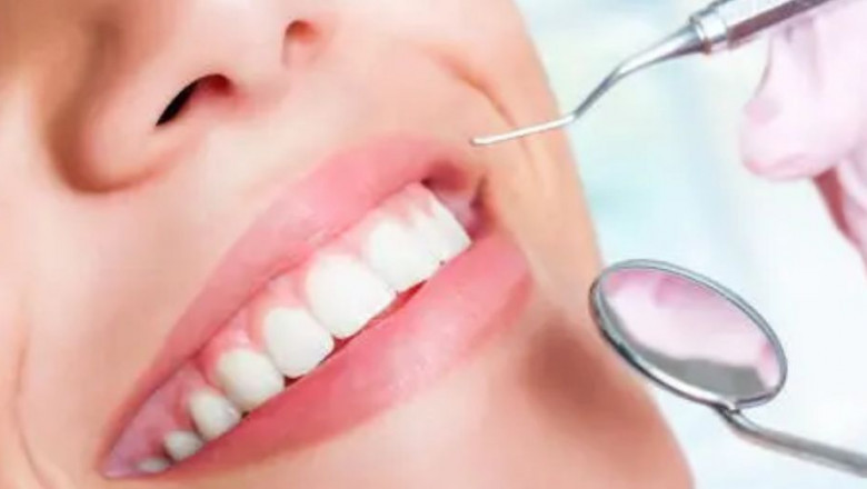 When Should You Visit a Dentist for a Check-Up?