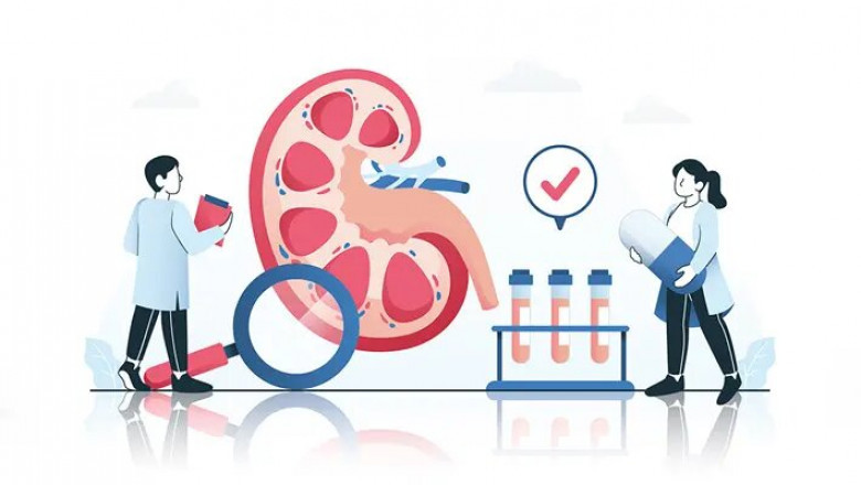 How to Prepare for a Kidney Function Blood Test: A Step-by-Step Guide