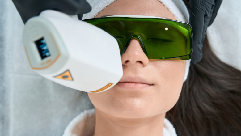Laser Hair Removal Cost in Delhi: Your Complete Guide