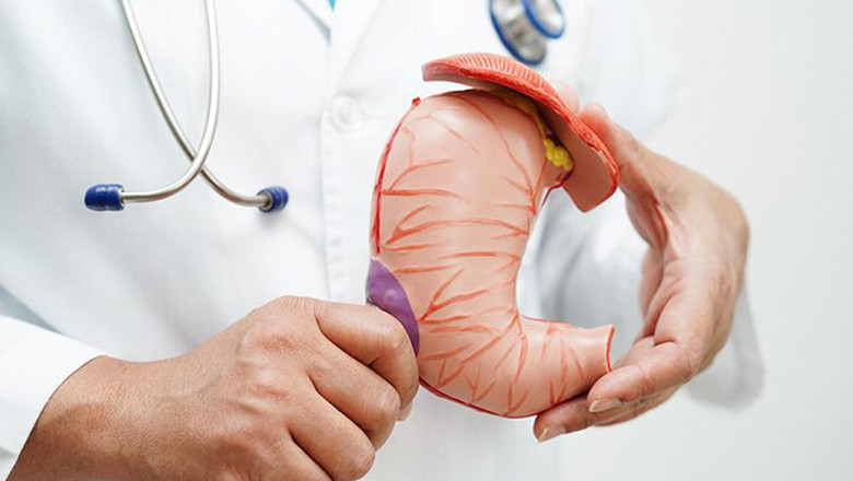 All About Gastric Polyps and Should You Be Worried if You Have Them