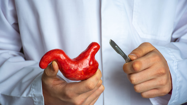 The Dos and Don’ts After Bariatric Surgery in Islamabad