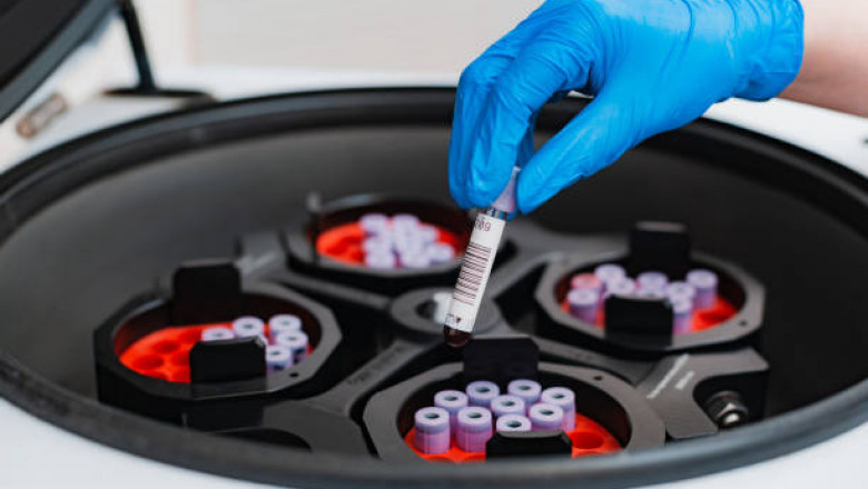 Centrifuge Market