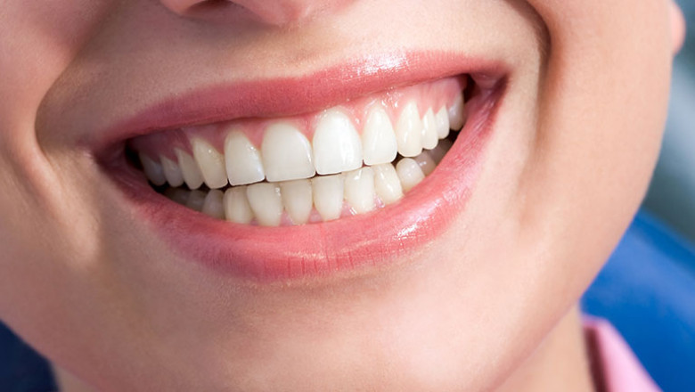 Gum Contouring: Everything You Need to Know