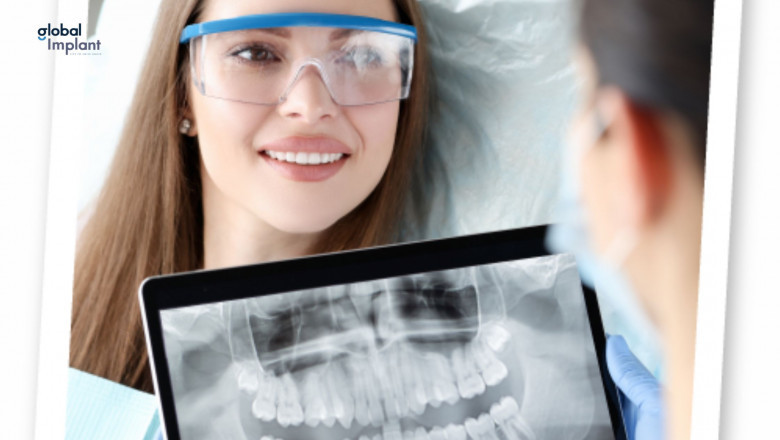 The Role of Digital X-Rays in Modern Dentistry