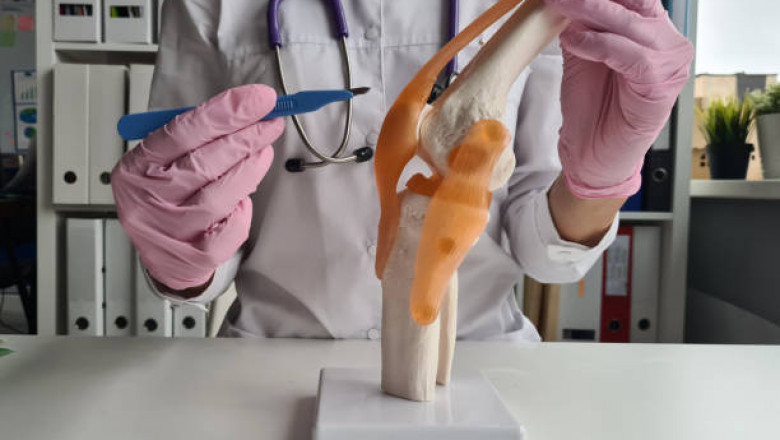 Cartilage Repair Market Strategies