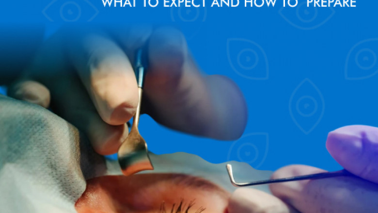 Cataract Surgery: What to Expect and How to Prepare