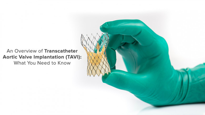 Transcatheter Aortic Valve Implantation (TAVI) Market Strategies
