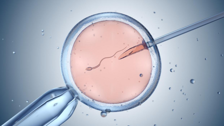 Artificial Insemination: A Comprehensive Guide to Fertility Treatment Options and Success Rates