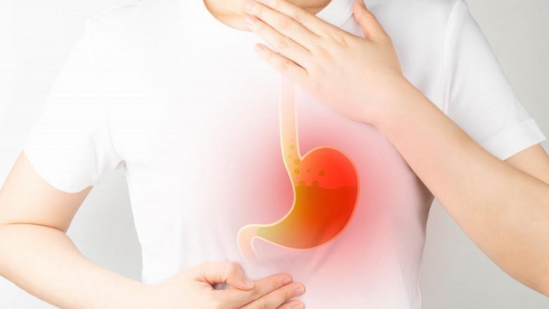 Heartburn: Causes, Symptoms, and When to Seek Medical Help