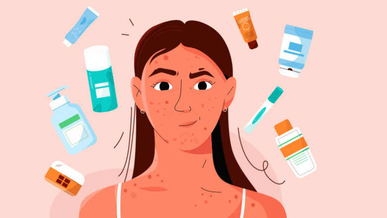 The Amazing Benefits of BHA Exfoliant for Clear and Radiant Skin