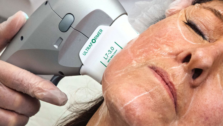 HIFU Treatment: The Non-Surgical Solution for Tight, Glowing Skin