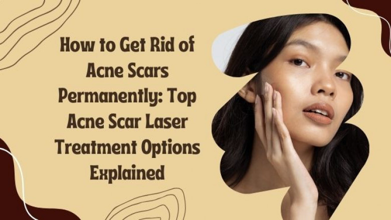 How to Get Rid of Acne Scars Permanently: Top Acne Scar Laser Treatment Options Explained