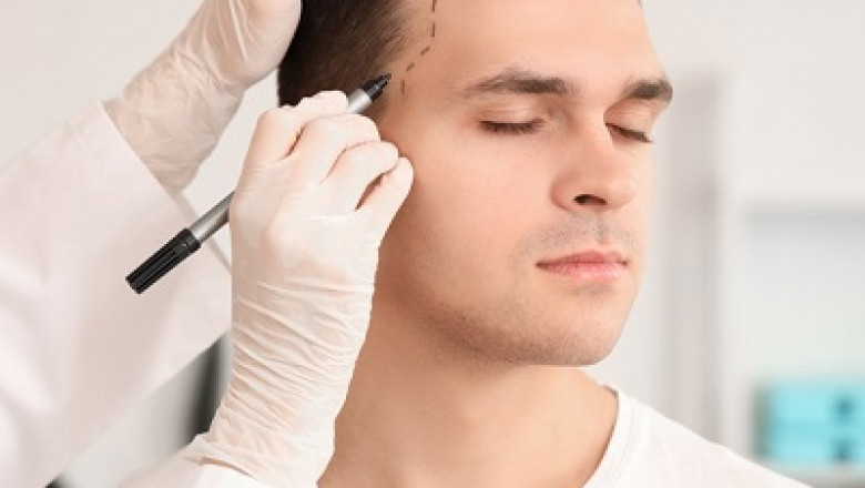 Achieve a Thicker, Fuller Hairline with Dubai’s Top Solutions
