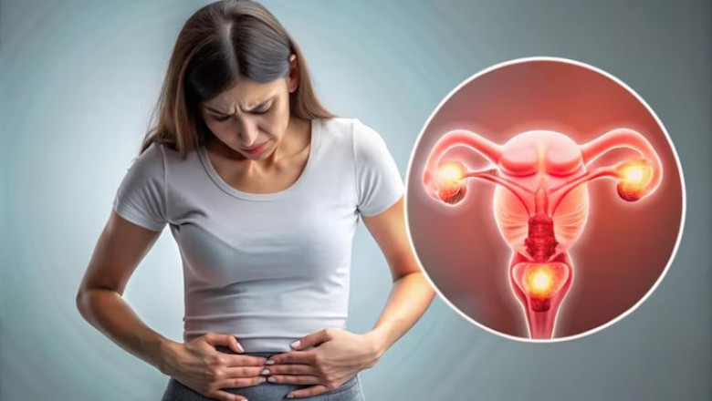 Best PCOD Doctor in Noida – Expert PCOS Treatment by Dr. Anu Goswami
