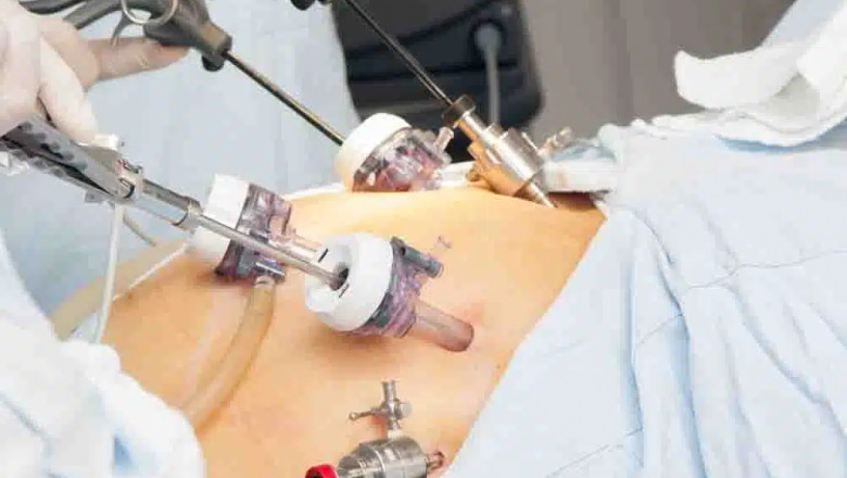 CERTIFICATE IN MINIMAL ACCESS SURGERY - ONLINE COURSE