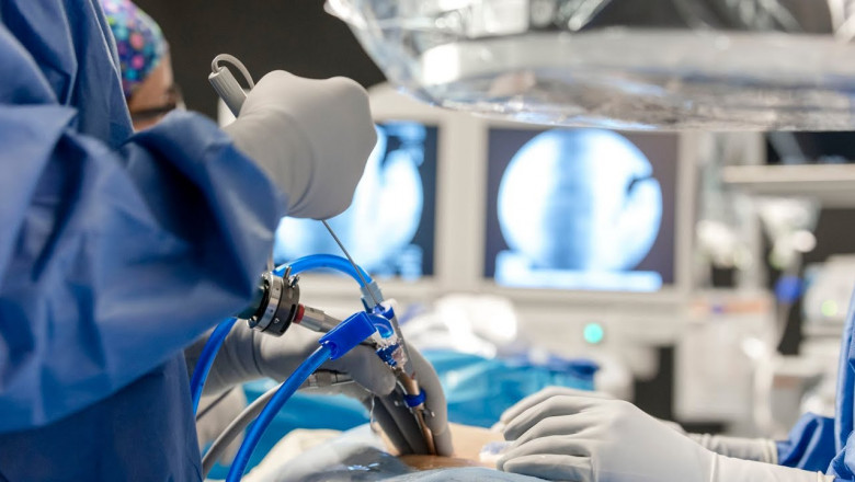 Veterinary Endoscope Market Insights Point to Higher Investment in Diagnostic Equipment by Veterinarians