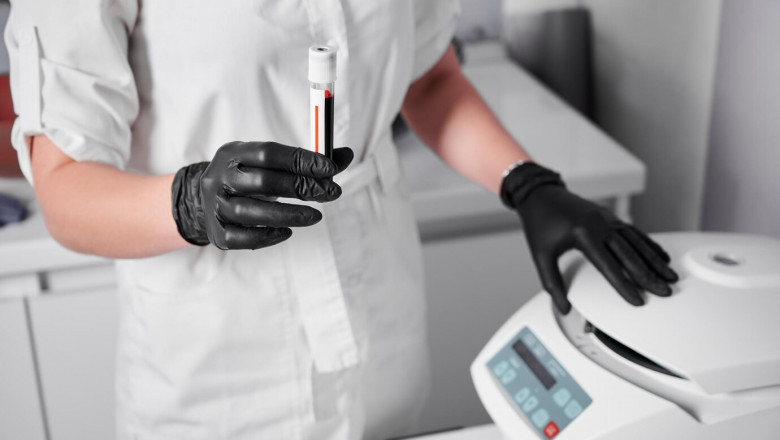 Healthcare Industry Trends Supporting Expansion of the Blood Volume Analyzer Market
