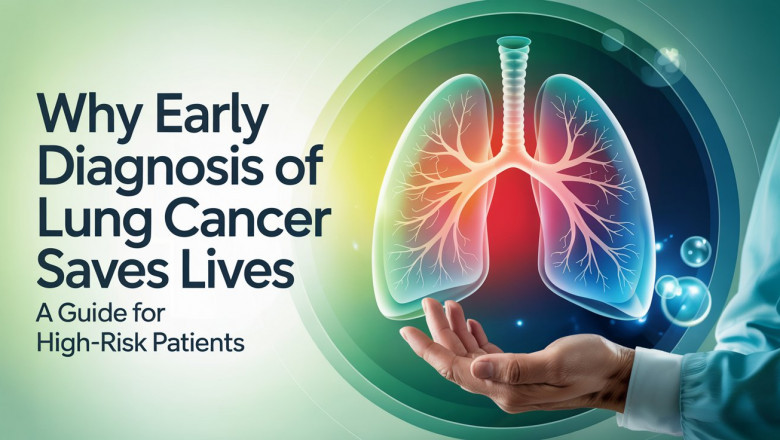 Why Early Diagnosis of Lung Cancer Saves Lives: A Guide for High-Risk Patients