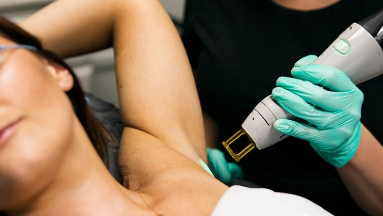 Be Smooth, Be Radiant with Laser Hair Removal