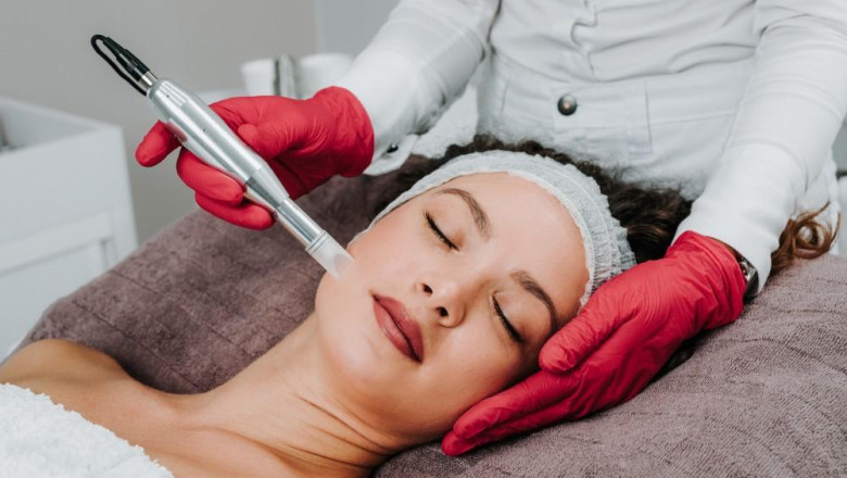 The Benefits of Microneedling Treatment for Skin Rejuvenation