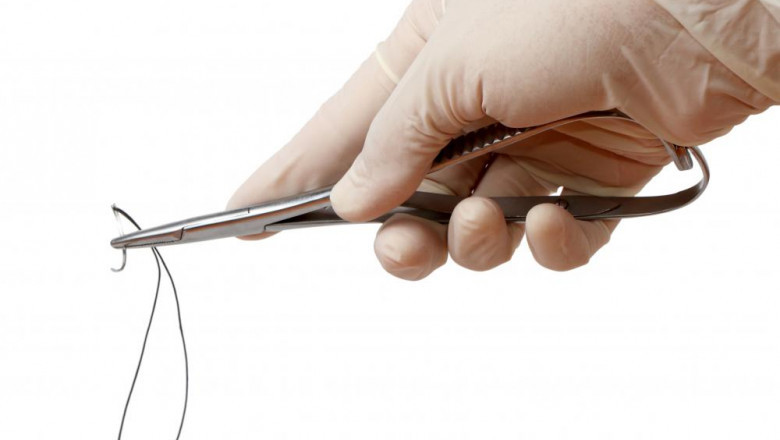 Veterinary Sutures Market Impacting Factors: Regional Growth Drivers and Market Trends Influencing Sutures Demand