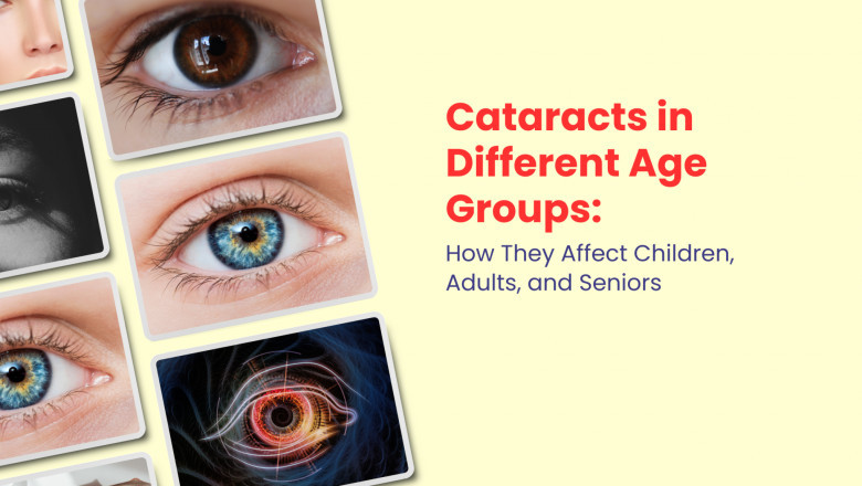 Cataracts in Different Age Groups: How They Affect Children, Adults, and Seniors