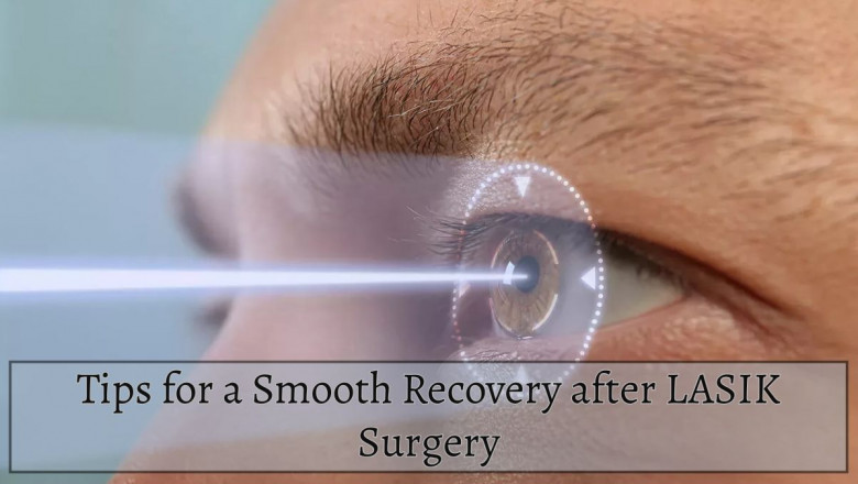 7 Tips for a Smooth Recovery after LASIK Surgery