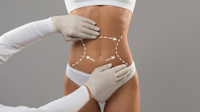 Get Your Body Goals with Safe, Professional Liposuction