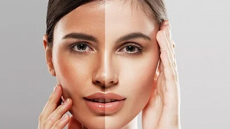 Go Natural: Skin Whitening Treatments in Dubai Without Harsh Chemicals