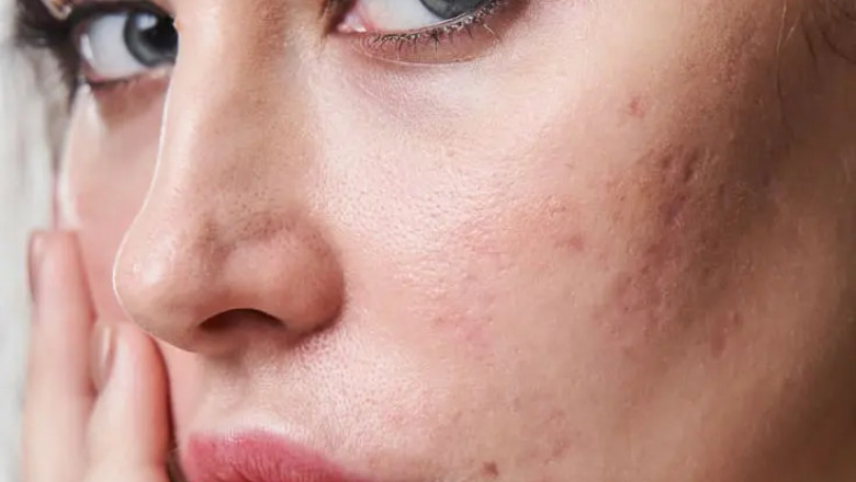 Dr. Rabia Hayat Dermatologist in Lahore