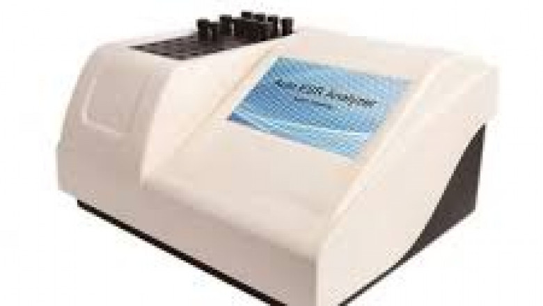 ESR Analyzer Market: Innovations Driving the Shift from Manual to Automated Blood Testing Systems