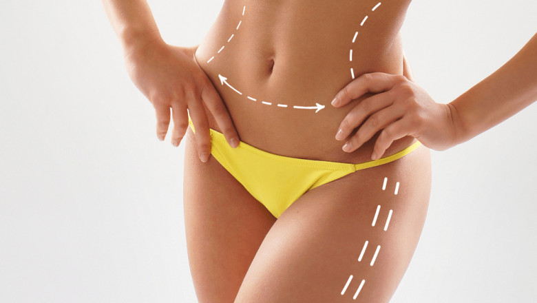 Gen Z’s New Favorite: Laser Liposuction in Dubai