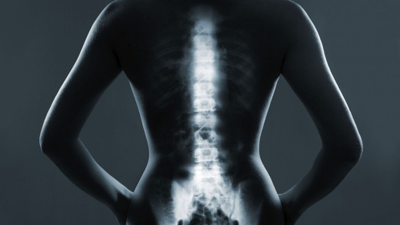 Targeted Therapies and Biomarkers: Key Trends in the Metastatic Bone Cancer Market