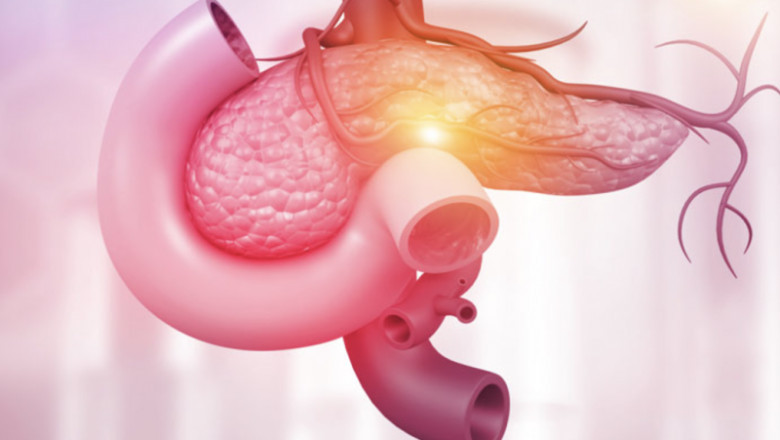 Pancreatic Cancer Treatment Market Business Operation Data 2033