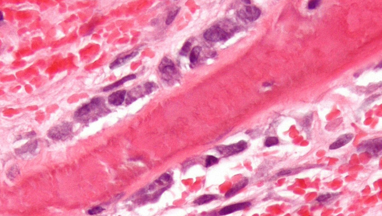 Human Osteoblasts Market to Soar with Bone Regeneration