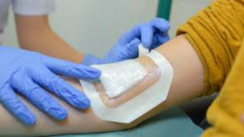 Medical Adhesives Market: Fueling Innovation in Modern Healthcare