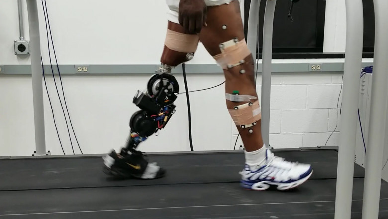 Artificial Limbs Market: Exploring Technological Advancements and Future Growth Prospects in Prosthetics