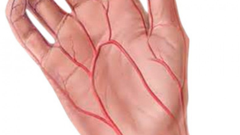 Buerger’s Disease Market to Surge Owing to Stem Cell Therapy Growth