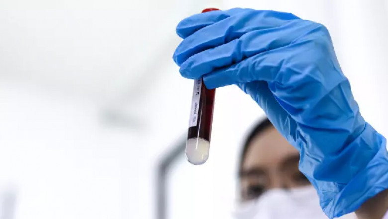 Sepsis: How Blood Infection Spreads and Ways to Prevent It