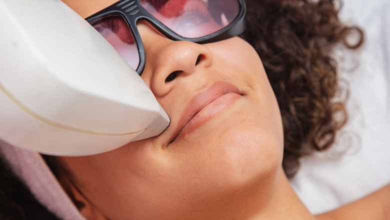 Unlock Your Best Skin Yet with Affordable Laser Hair Removal Deals