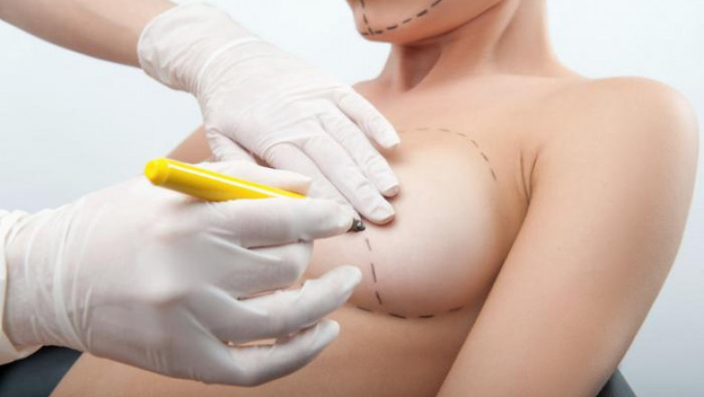 What Are the Best Breast Implant Options for You?